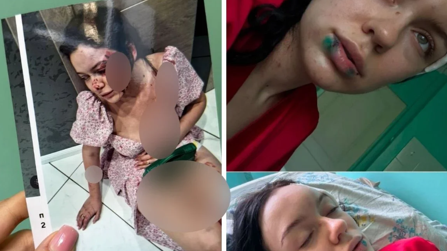 "Тепкінің астына алып, белгісіз дәрі ішкізді": Екібастұз тұрғынын бұрынғы сүйіктісі сағаттап сабаған (ФОТО)