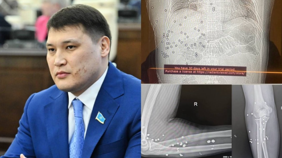 Руслан Берденовке оқ атылған мылтық елордада есептен шығарылған